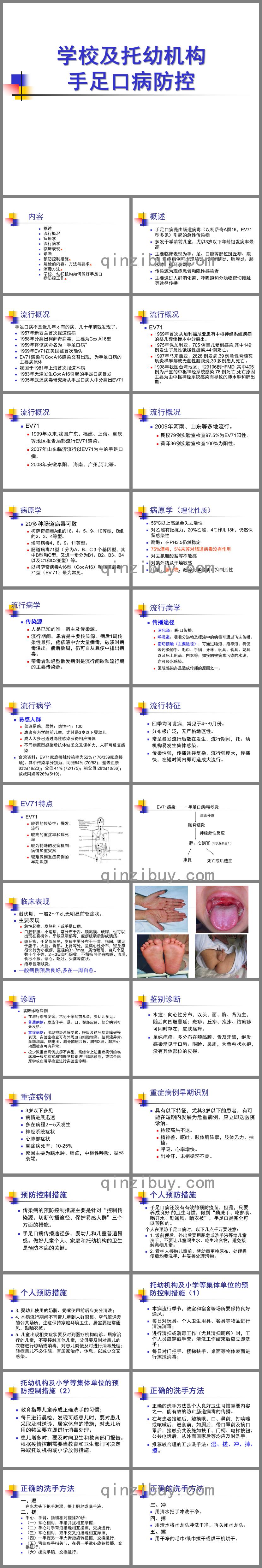 幼兒園手足口病防控PPT課件