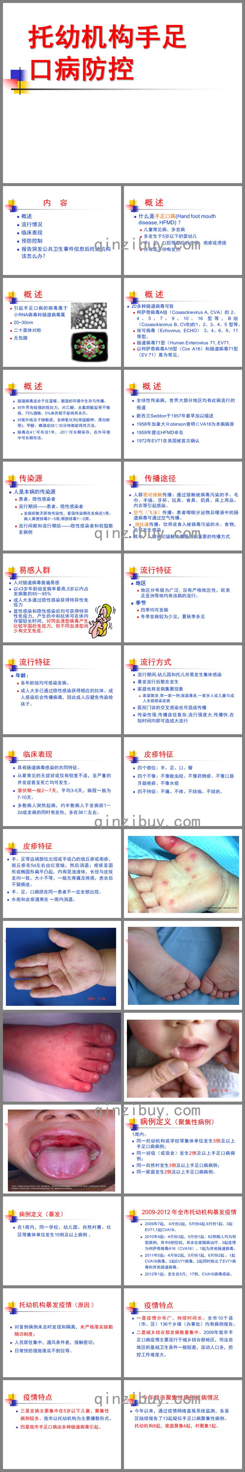 幼兒園手足口病防控培訓材料PPT課件