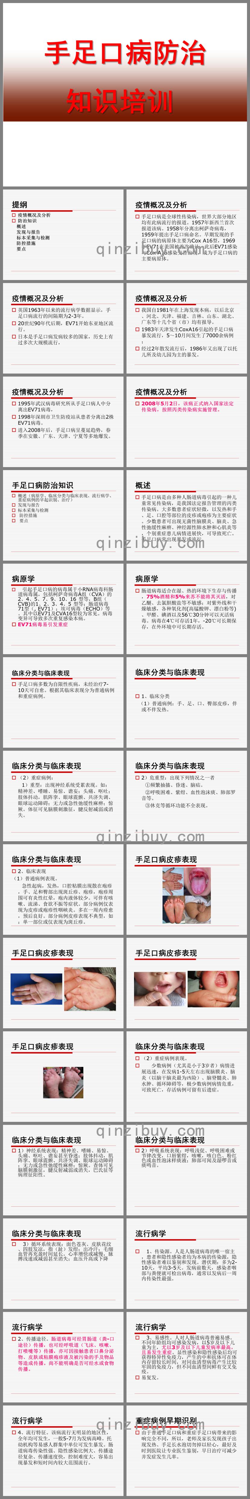 幼兒園手足口病防治知識培訓PPT課件