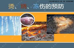 幼兒園大班安全防止?fàn)C傷PPT課件