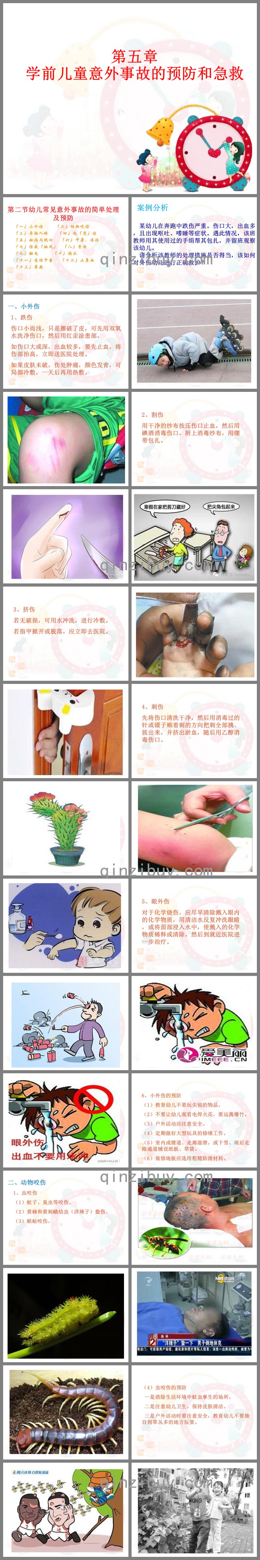 5.2幼兒常見意外事故的簡單處理及預防PPT課件